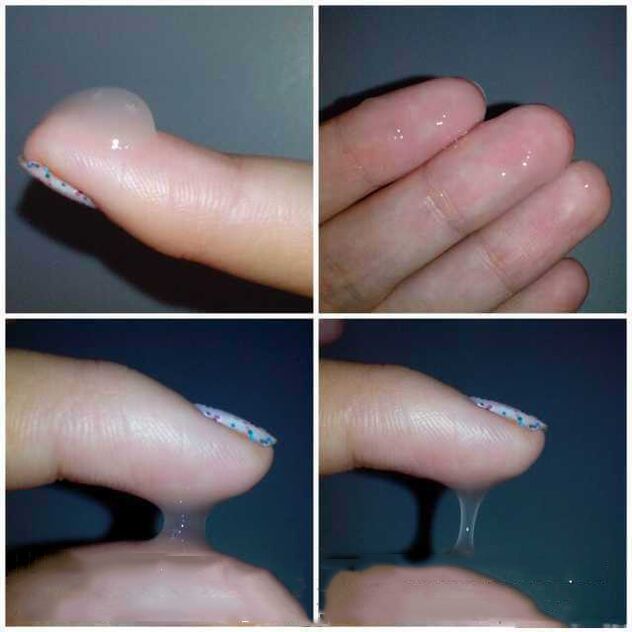 What it looks like
